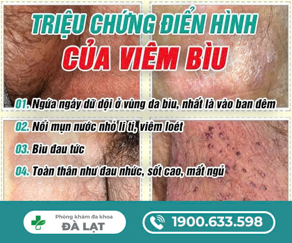 Hình ảnh minh họa